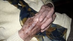 Läs mer om artikeln Vård i livets slut